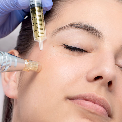 plasma-rico-en-plaquetas-oruro-01